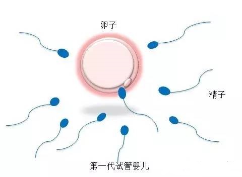拉拉试管三代代孕机构